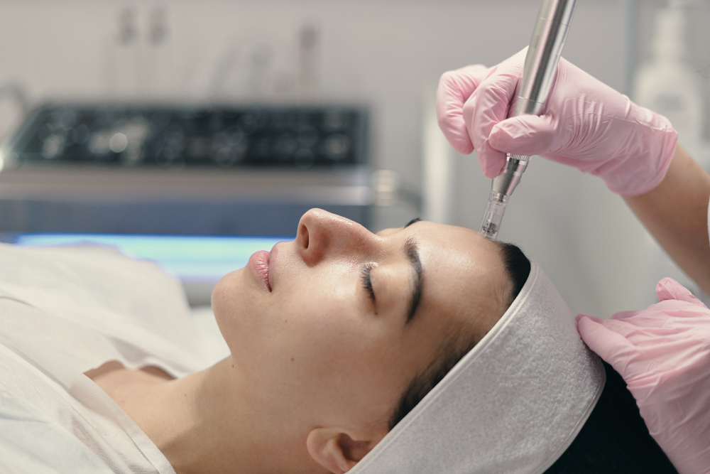 PRF being applied during microneedling at Valoura Med Spa in Savoy, IL