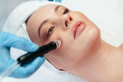 RF Microneedling treatment at Valoura Med Spa